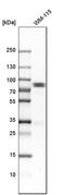 Holliday Junction Recognition Protein antibody, HPA008436, Atlas Antibodies, Western Blot image 