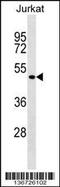 Forkhead Box B2 antibody, 59-013, ProSci, Western Blot image 