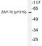 Zeta Chain Of T Cell Receptor Associated Protein Kinase 70 antibody, LS-C178008, Lifespan Biosciences, Western Blot image 