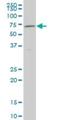 Nuclear Receptor Subfamily 4 Group A Member 2 antibody, H00004929-M10, Novus Biologicals, Western Blot image 