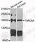 Trinucleotide Repeat Containing Adaptor 6A antibody, A6115, ABclonal Technology, Western Blot image 