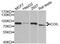 Coilin antibody, A6428, ABclonal Technology, Western Blot image 