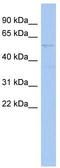 SET And MYND Domain Containing 2 antibody, TA339738, Origene, Western Blot image 