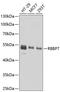 RB Binding Protein 7, Chromatin Remodeling Factor antibody, A13456, ABclonal Technology, Western Blot image 