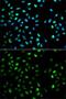 Dysbindin-1 antibody, GTX53985, GeneTex, Immunofluorescence image 