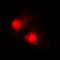 Retinoic Acid Receptor Beta antibody, orb214497, Biorbyt, Immunofluorescence image 