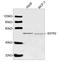 Somatostatin receptor type 2 antibody, LS-C203247, Lifespan Biosciences, Western Blot image 