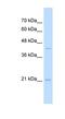 MAF BZIP Transcription Factor K antibody, NBP1-79224, Novus Biologicals, Western Blot image 