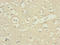 DSN1 Component Of MIS12 Kinetochore Complex antibody, LS-C675664, Lifespan Biosciences, Immunohistochemistry paraffin image 