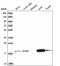 ADP Ribosylation Factor Like GTPase 17B antibody, PA5-61339, Invitrogen Antibodies, Western Blot image 
