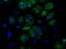 Fumarylacetoacetate Hydrolase Domain Containing 2A antibody, LS-C115030, Lifespan Biosciences, Immunofluorescence image 