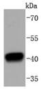 Histone Deacetylase 8 antibody, NBP2-67824, Novus Biologicals, Western Blot image 