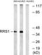Ribosome Biogenesis Regulator 1 Homolog antibody, GTX87140, GeneTex, Western Blot image 