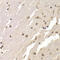 Hrb antibody, LS-C334618, Lifespan Biosciences, Immunohistochemistry paraffin image 