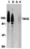 ADAM Metallopeptidase Domain 17 antibody, orb74324, Biorbyt, Western Blot image 