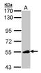 LCK Proto-Oncogene, Src Family Tyrosine Kinase antibody, LS-B8908, Lifespan Biosciences, Western Blot image 