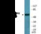 Autoimmune Regulator antibody, EKC2603, Boster Biological Technology, Western Blot image 