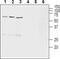 Solute Carrier Family 18 Member A2 antibody, PA5-77496, Invitrogen Antibodies, Western Blot image 