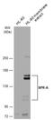 Natriuretic Peptide Receptor 1 antibody, GTX109810, GeneTex, Western Blot image 