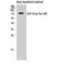 Lymphocyte Cytosolic Protein 2 antibody, LS-C381393, Lifespan Biosciences, Western Blot image 