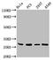 EF-Hand Domain Family Member D1 antibody, CSB-PA880107LA01HU, Cusabio, Western Blot image 