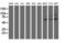 AP2M1 antibody, M06179-1, Boster Biological Technology, Western Blot image 