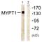 Protein Phosphatase 1 Regulatory Subunit 12A antibody, PA5-38298, Invitrogen Antibodies, Western Blot image 