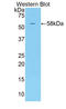 Killer Cell Immunoglobulin Like Receptor, Two Ig Domains And Short Cytoplasmic Tail 2 antibody, LS-C302099, Lifespan Biosciences, Western Blot image 