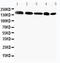 GLI Family Zinc Finger 2 antibody, LS-C313075, Lifespan Biosciences, Western Blot image 
