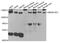 SWI/SNF-Related, Matrix-Associated Actin-Dependent Regulator Of Chromatin, Subfamily A, Containing DEAD/H Box 1 antibody, TA332959, Origene, Western Blot image 