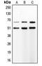 Matrix Metallopeptidase 8 antibody, LS-C352524, Lifespan Biosciences, Western Blot image 