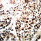 RAD51 Recombinase antibody, LS-C368492, Lifespan Biosciences, Immunohistochemistry frozen image 