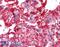 Radixin antibody, 45-137, ProSci, Western Blot image 