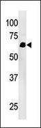 PTPN1 antibody, LS-C100983, Lifespan Biosciences, Western Blot image 