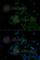 ADP Ribosylation Factor 6 antibody, A3162, ABclonal Technology, Immunofluorescence image 