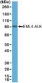 ALK Receptor Tyrosine Kinase antibody, NBP2-77424, Novus Biologicals, Western Blot image 