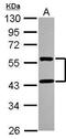 Matrix Metallopeptidase 28 antibody, PA5-30813, Invitrogen Antibodies, Western Blot image 