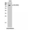 Nuclear Receptor Subfamily 3 Group C Member 1 antibody, LS-C381019, Lifespan Biosciences, Western Blot image 