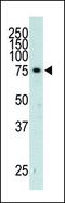 G Protein-Coupled Receptor Kinase 3 antibody, PA5-13727, Invitrogen Antibodies, Western Blot image 