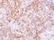 Lysyl-TRNA Synthetase antibody, GTX102179, GeneTex, Immunohistochemistry paraffin image 