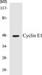 Cyclin E1 antibody, EKC1156, Boster Biological Technology, Western Blot image 