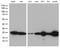O-6-Methylguanine-DNA Methyltransferase antibody, LS-C794743, Lifespan Biosciences, Western Blot image 