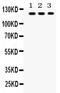 Toll Like Receptor 7 antibody, PB9452, Boster Biological Technology, Western Blot image 