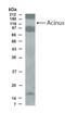 Apoptotic chromatin condensation inducer in the nucleus antibody, NB500-217, Novus Biologicals, Western Blot image 