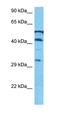 Spermatogenesis Associated Serine Rich 2 antibody, orb327396, Biorbyt, Western Blot image 