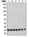 Matrix Metallopeptidase 7 antibody, orb214258, Biorbyt, Western Blot image 