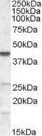 Abhydrolase Domain Containing 5 antibody, GTX89147, GeneTex, Western Blot image 