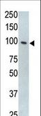 Toll Like Receptor 5 antibody, LS-C98275, Lifespan Biosciences, Western Blot image 