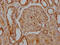 Integrin Subunit Alpha V antibody, CSB-RA548303A0HU, Cusabio, Immunohistochemistry paraffin image 