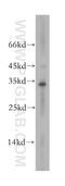Metallophosphoesterase Domain Containing 2 antibody, 13270-1-AP, Proteintech Group, Western Blot image 